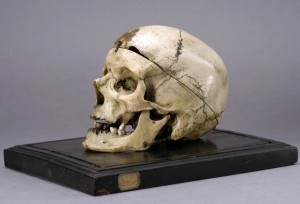 Il cranio di Villella esposto al Museo Lombroso di Torino.